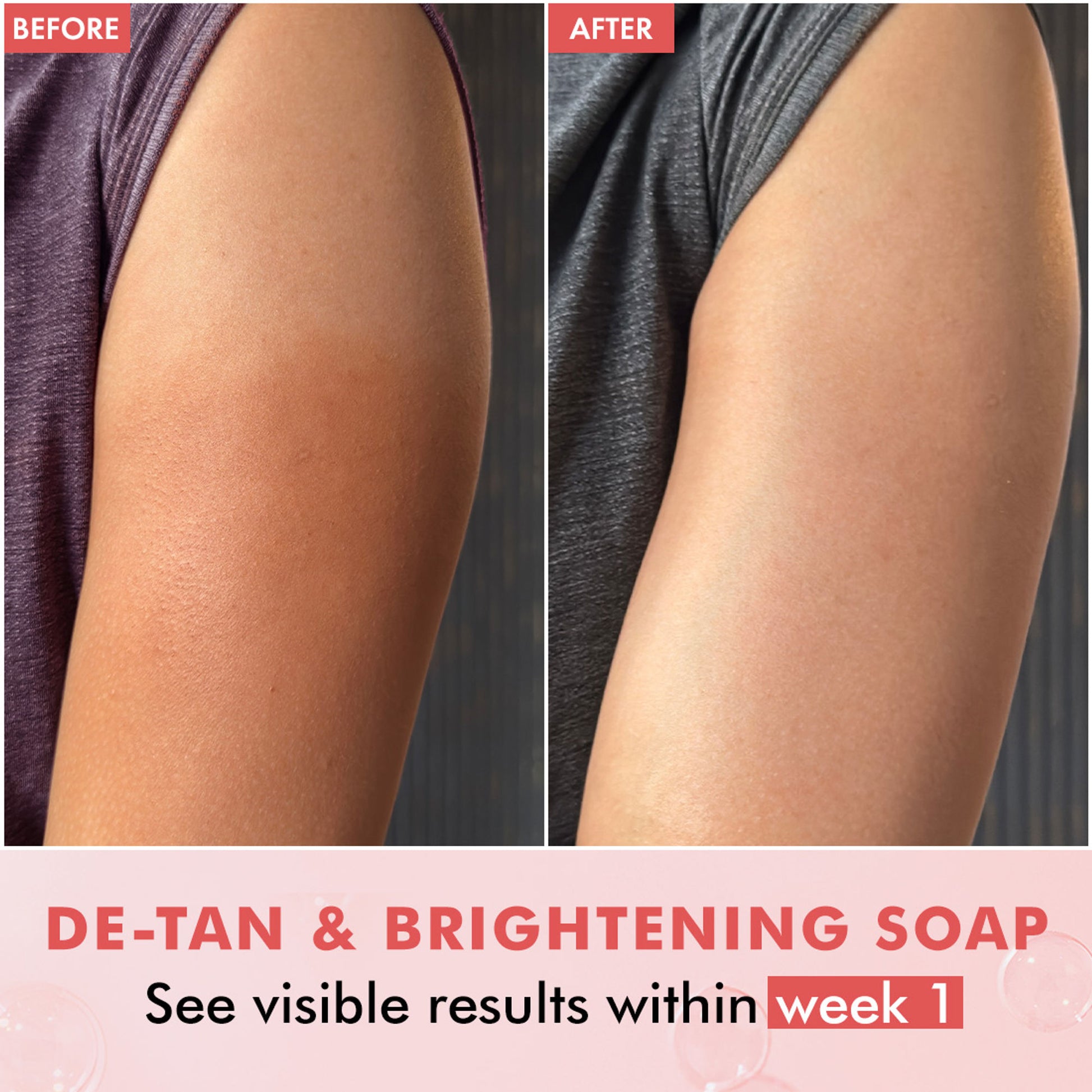 mCaffeine Brightening Tan Removal Soap - 1% Kojic Acid & Glutathione -Tangy Guava Perfume Syndet Bar
