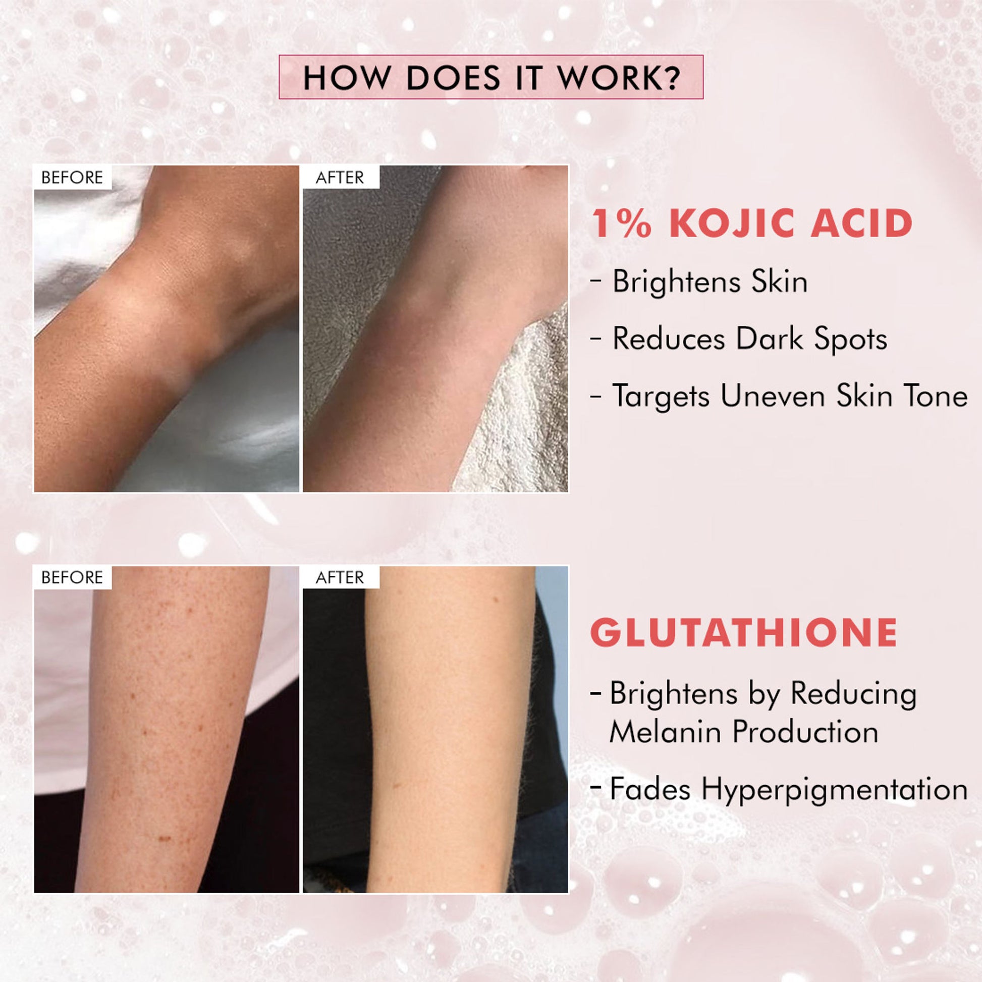 mCaffeine Brightening Tan Removal Soap - 1% Kojic Acid & Glutathione -Tangy Guava Perfume Syndet Bar