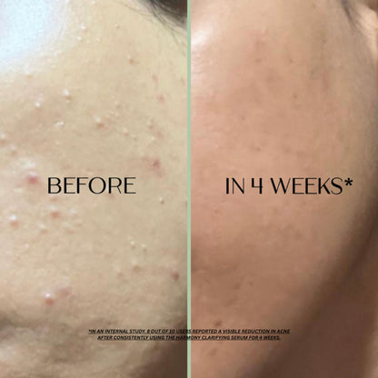 Ilana Harmony Azelaic Acid Serum