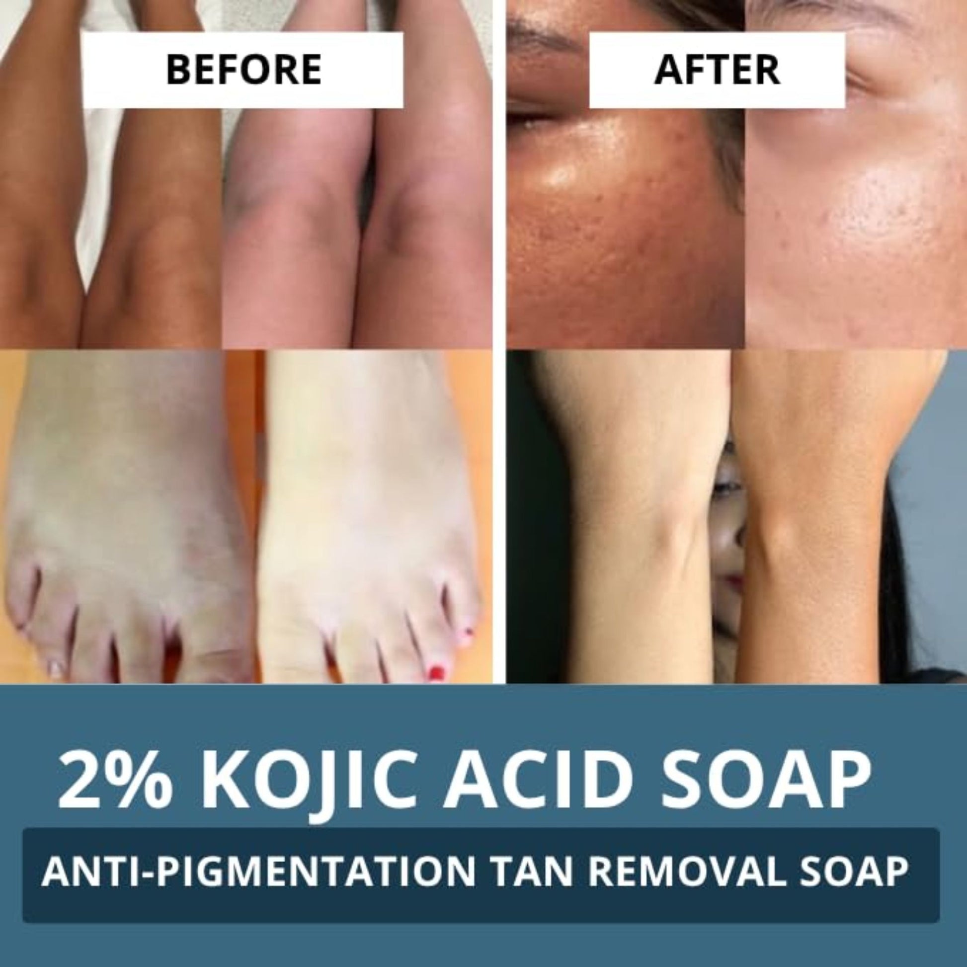 BAKE 2% Kojic Acid Soap For Pigmentation, Dark Spots & Tan Removal