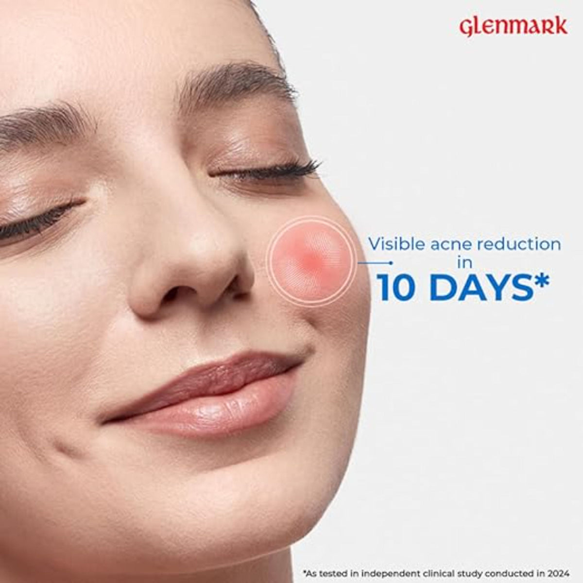 D'Acne Foaming Face Wash with 2% Salicylic Acid and 1% Glycolic Acid, demonstrating clear skin and foaming texture.