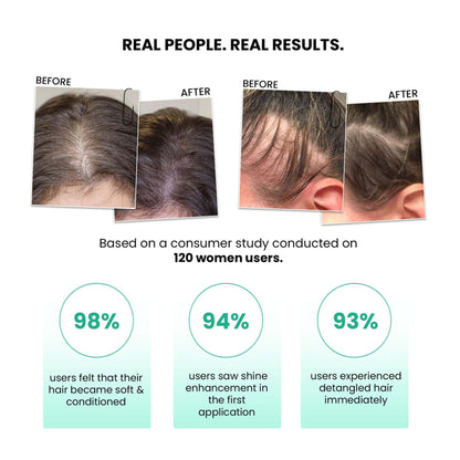 Thriveco 100% Natural Rosemary Water Hair Spray With Rice Water & Hyaluronic Acid For Frizz Control