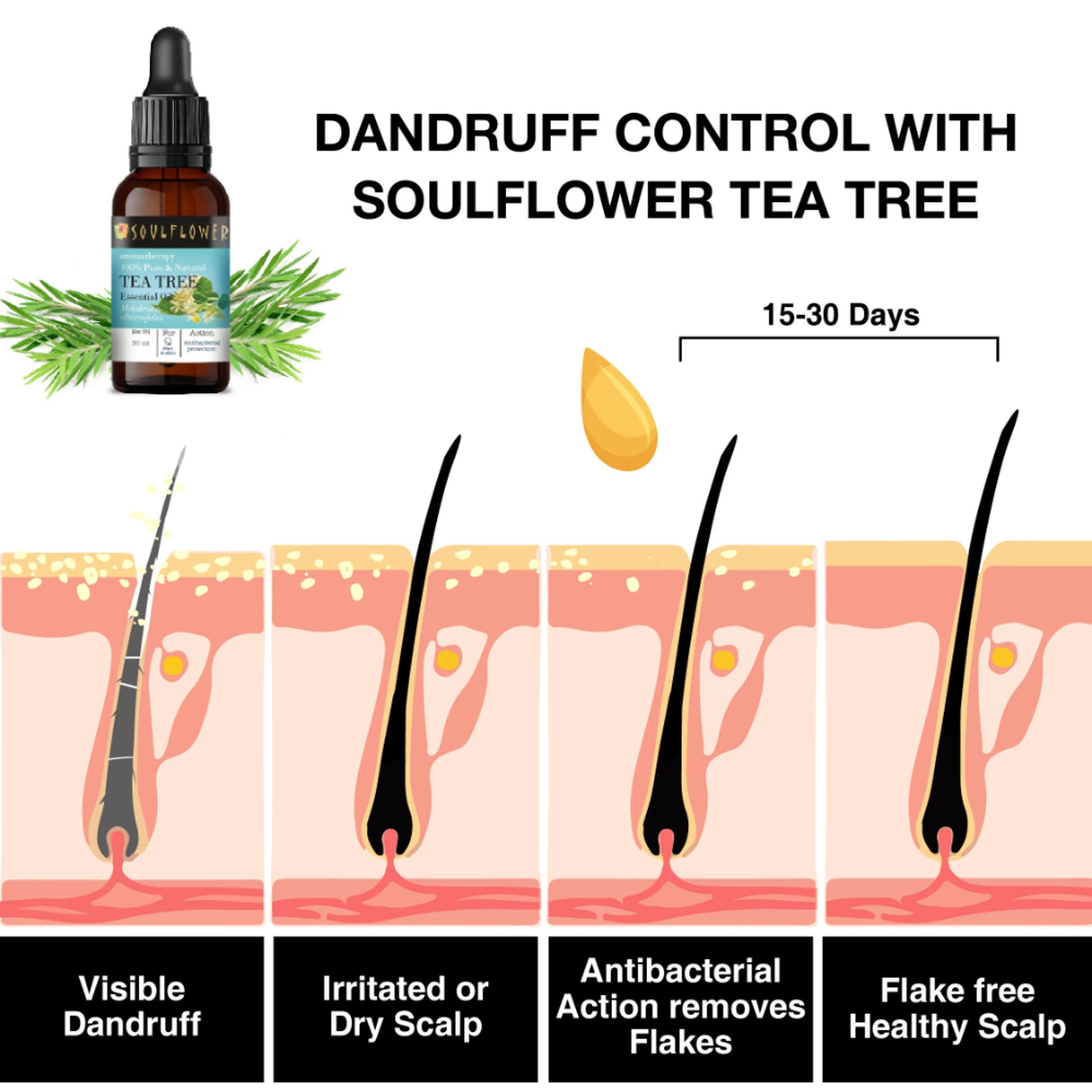 Soulflower Tea Tree Essential Oil For Active Acne & Pimples, Blemishes & Flakes