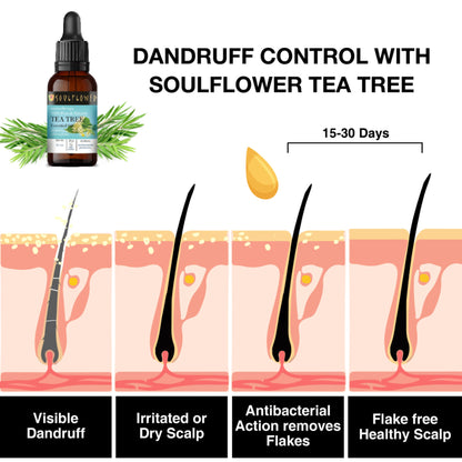 Soulflower Tea Tree Essential Oil For Active Acne & Pimples, Blemishes & Flakes