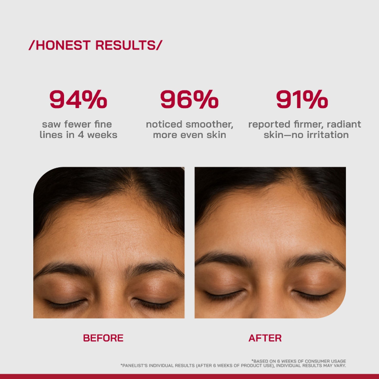 Proven Honest Derma (PHD) 0.3% Retinol Serum With Bakuchiol & Peptides