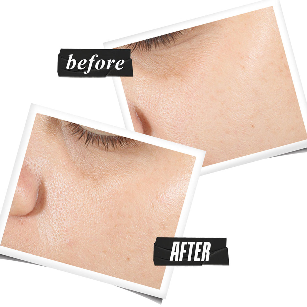 Kiehl's Ultra Pure High-Potency Serum - With 1.5 Hyaluronic Acid