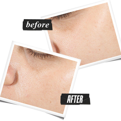Kiehl's Ultra Pure High-Potency Serum - With 1.5 Hyaluronic Acid