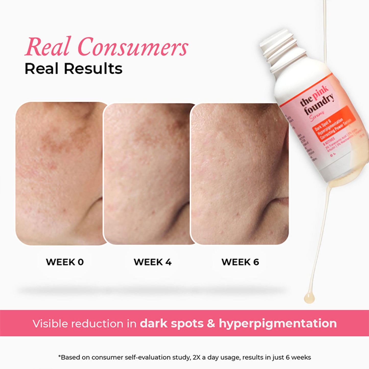 The Pink Foundry Dark Spot & Hyperpigmentation Face Serum
