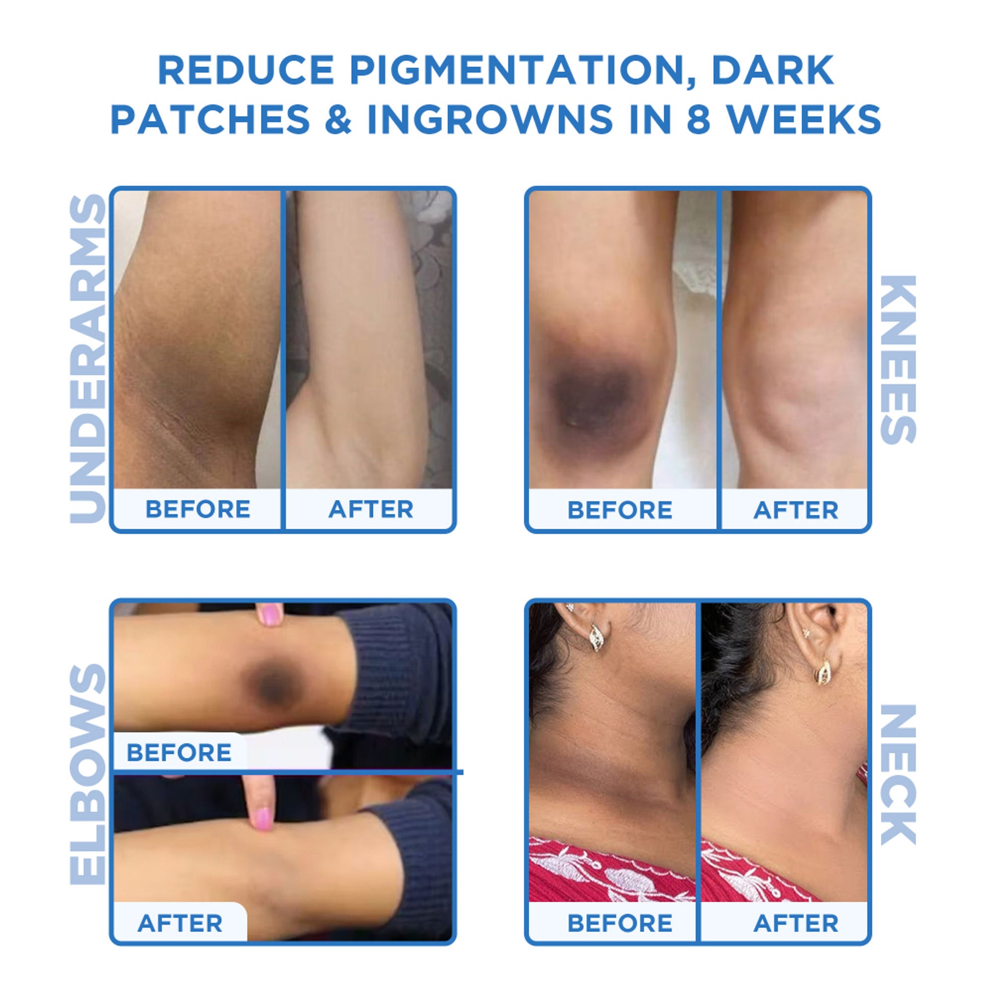 Orgatre Instant Tan & Dead Skin Removal Exfoliating Gel For Women & Men - Tanning Dead Skin Remover