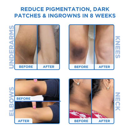 Orgatre Instant Tan & Dead Skin Removal Exfoliating Gel For Women & Men - Tanning Dead Skin Remover