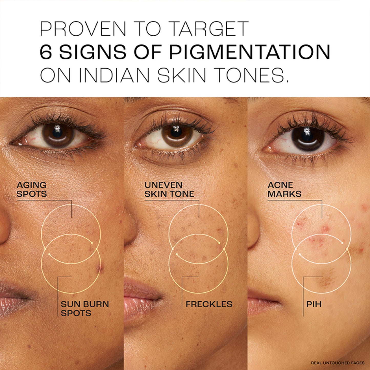 Lakme Perfect Radiance Pigmentation Treatment Gel with 10% Niacinamide Resorcinol Complex, 50g