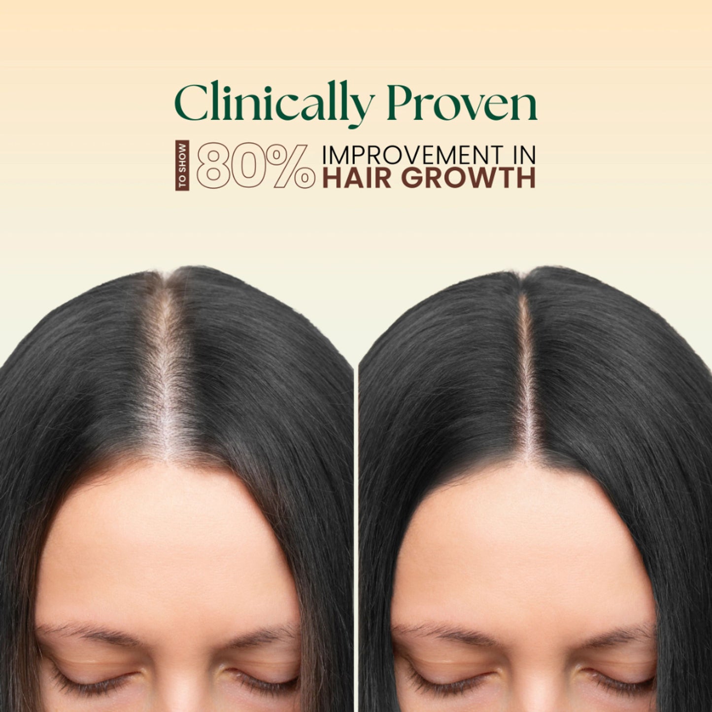 Moha 5 In 1 Hair Oil