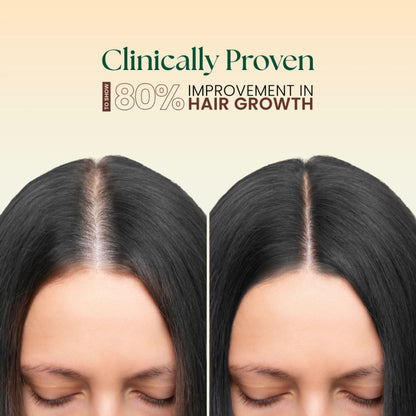 Moha 5 In 1 Hair Oil