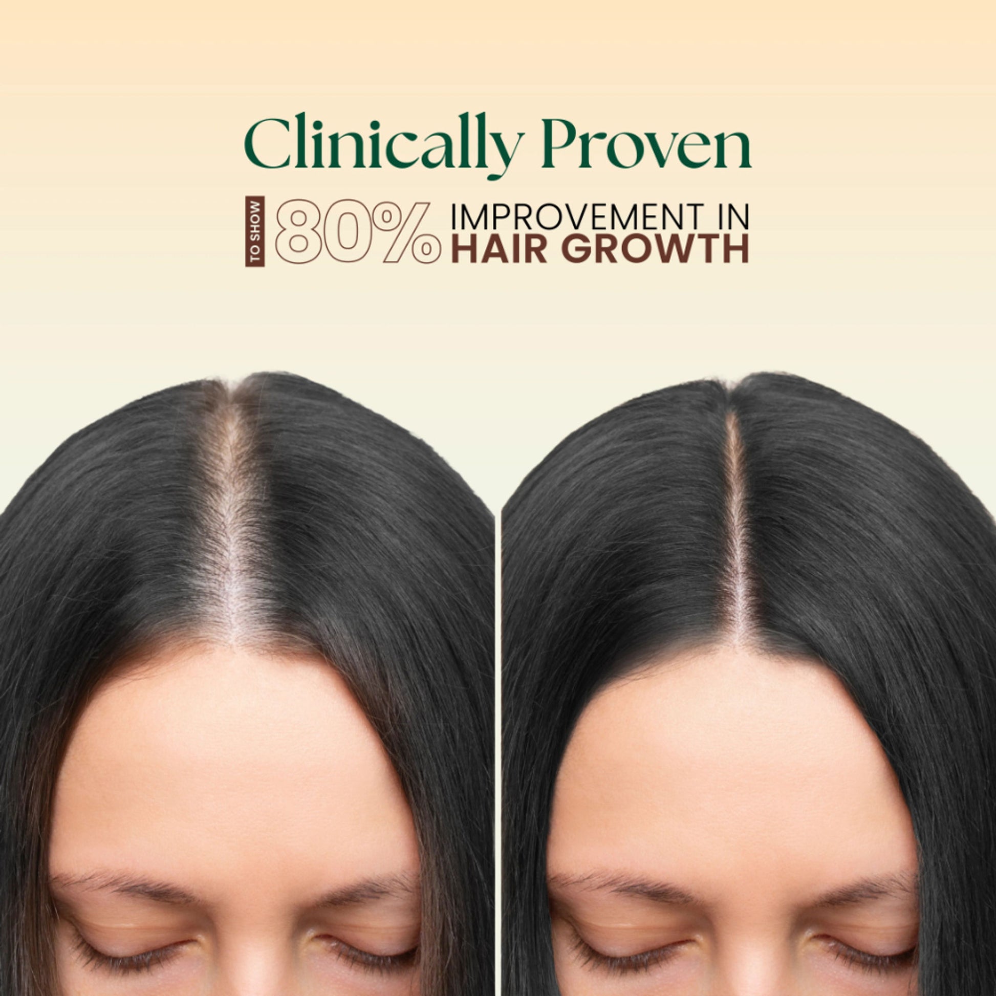Moha 5 In 1 Hair Oil