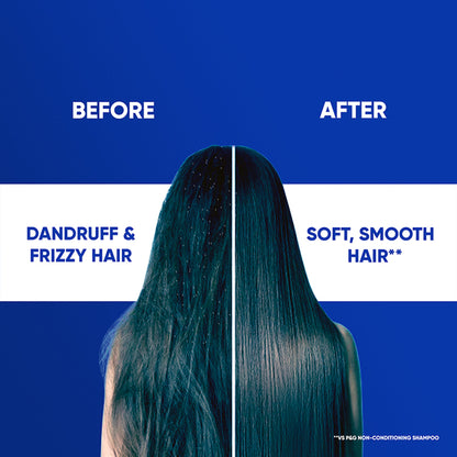 Head & Shoulders Cool Menthol 2-in-1 Shampoo + Conditioner