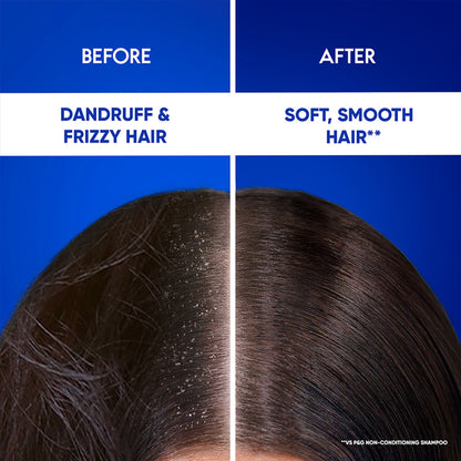 Head & Shoulders Cool Menthol 2-in-1 Anti-Dandruff Shampoo + Conditioner