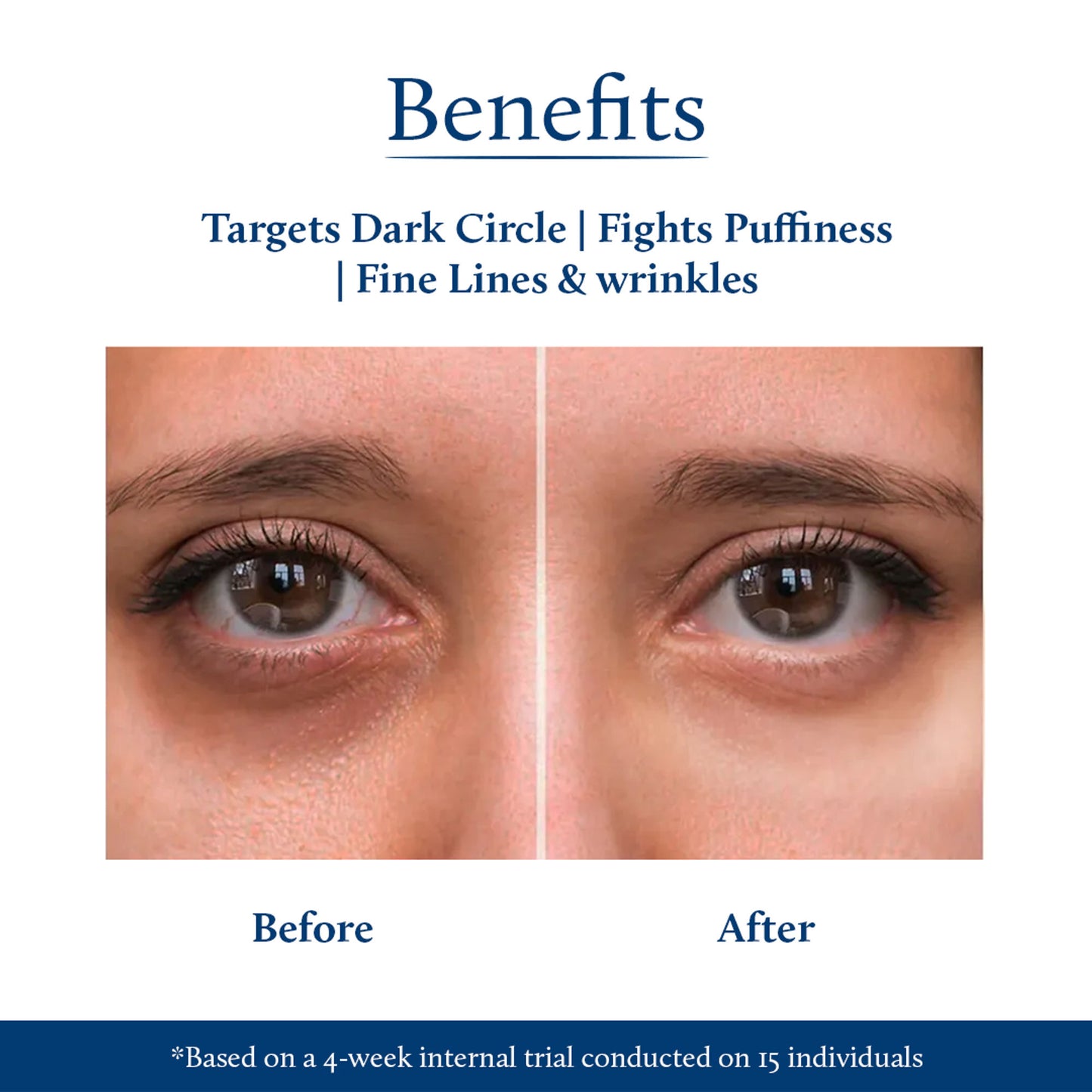 Blue Nectar Under Eye Cream For Dark Circles Natural Niacinamide