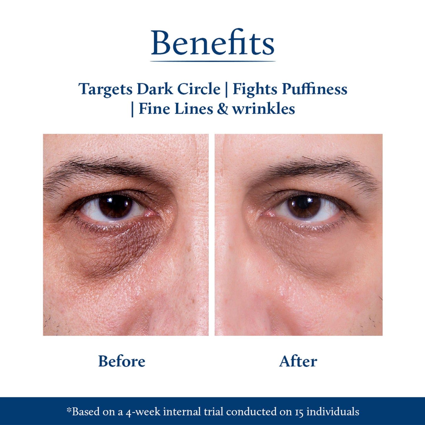 Blue Nectar Under Eye Cream Plant-Based Niacinamide For Men