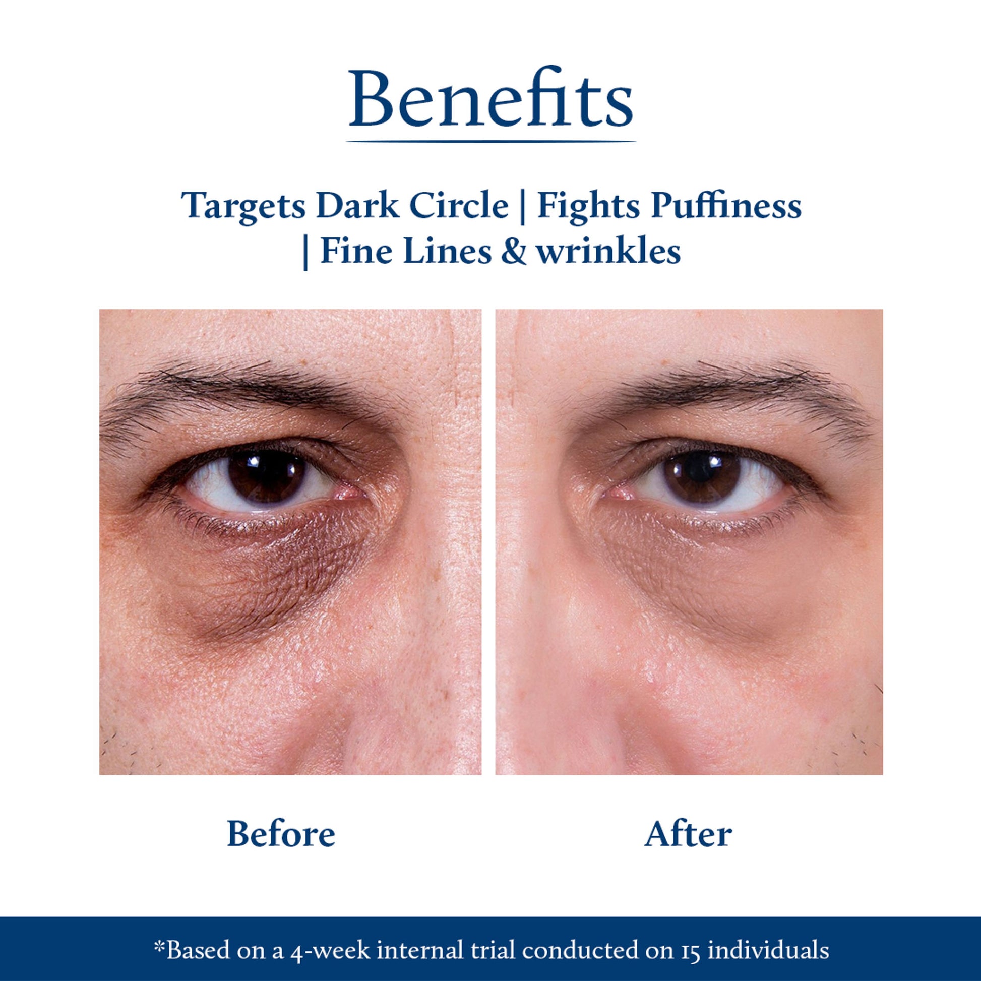 Blue Nectar Under Eye Cream Plant-Based Niacinamide For Men