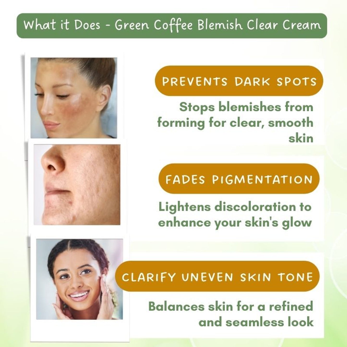 Mystiq Living Pigmentation Removal Cream, Brightening Day And Night Cream Kojic Acid, Niacinamide