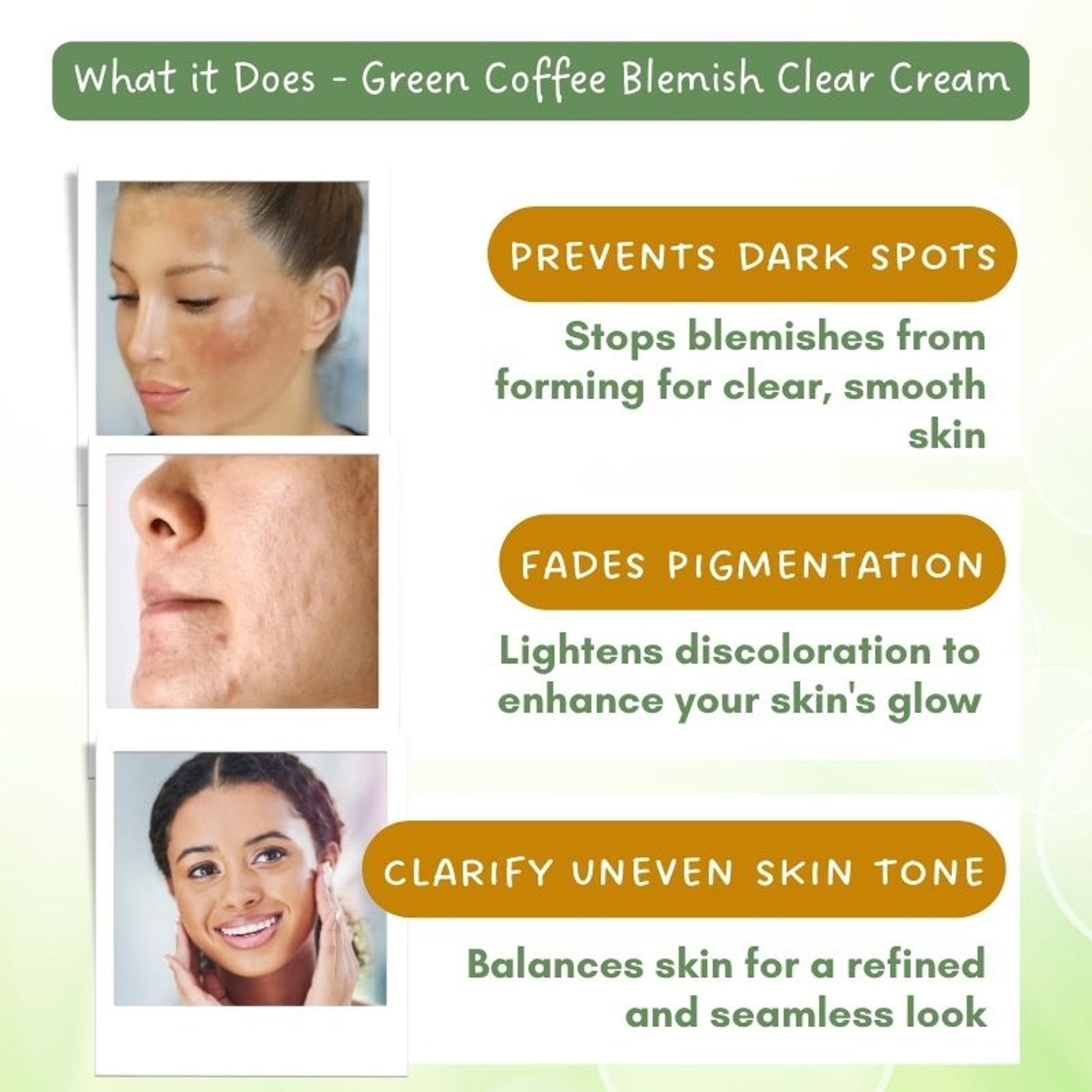 Mystiq Living Pigmentation Removal Cream, Brightening Day And Night Cream Kojic Acid, Niacinamide