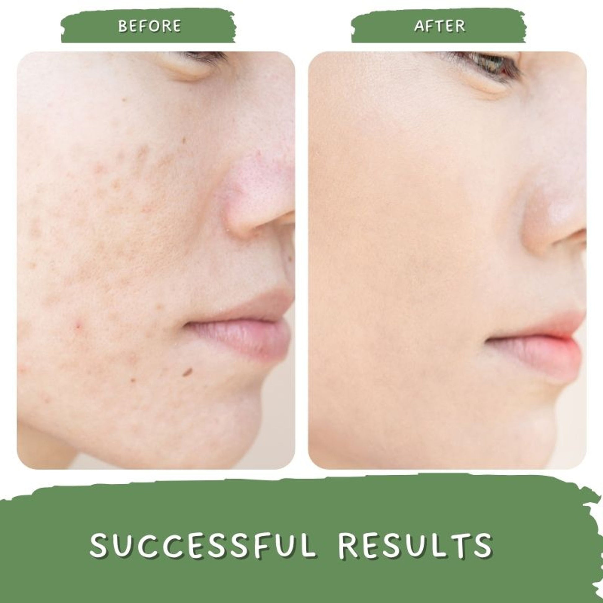 Mystiq Living Pigmentation Removal Cream, Brightening Day And Night Cream Kojic Acid, Niacinamide