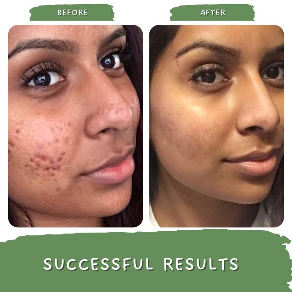 Mystiq Living Face Scrub & Exfoliator For Blackheads, Tan Removal For Glowing Skin With Walnut