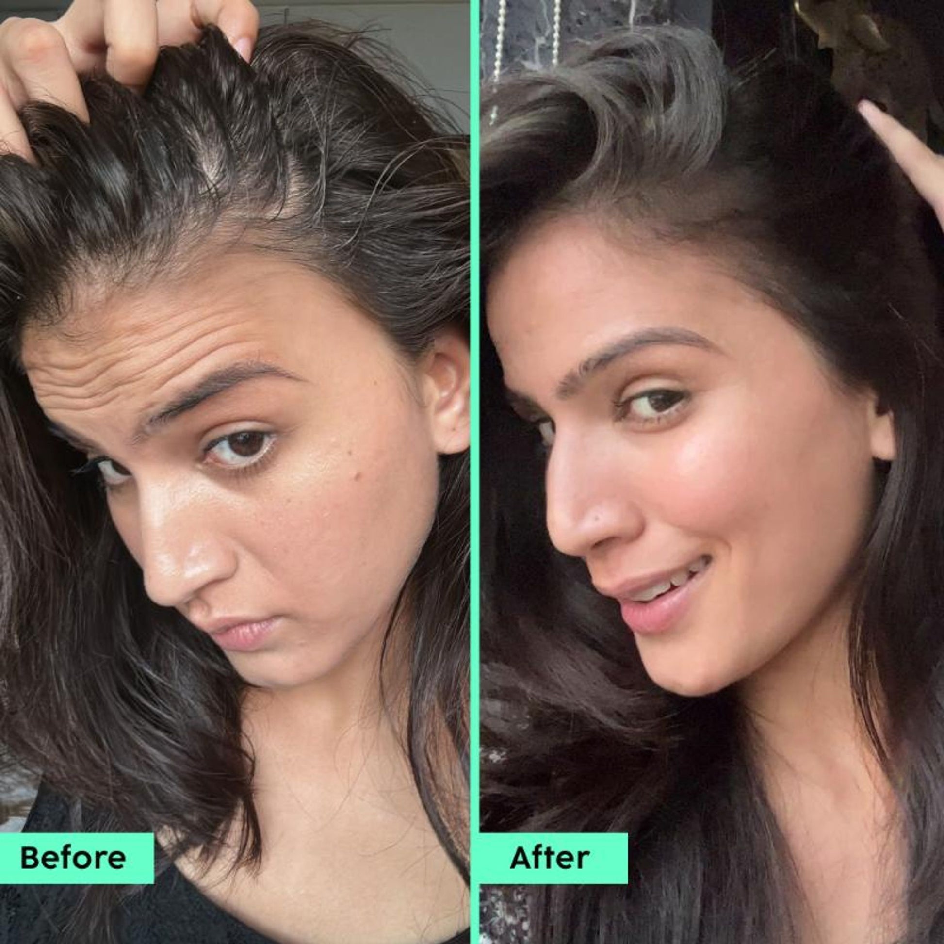 Plix Rosemary Hair Growth Serum With 3% Redensyl, 4% AnaGain, 3% Baicapil, Thickens Hair