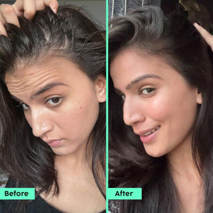 Plix Rosemary Hair Growth Serum With 3% Redensyl, 4% AnaGain, 3% Baicapil, Thickens Hair