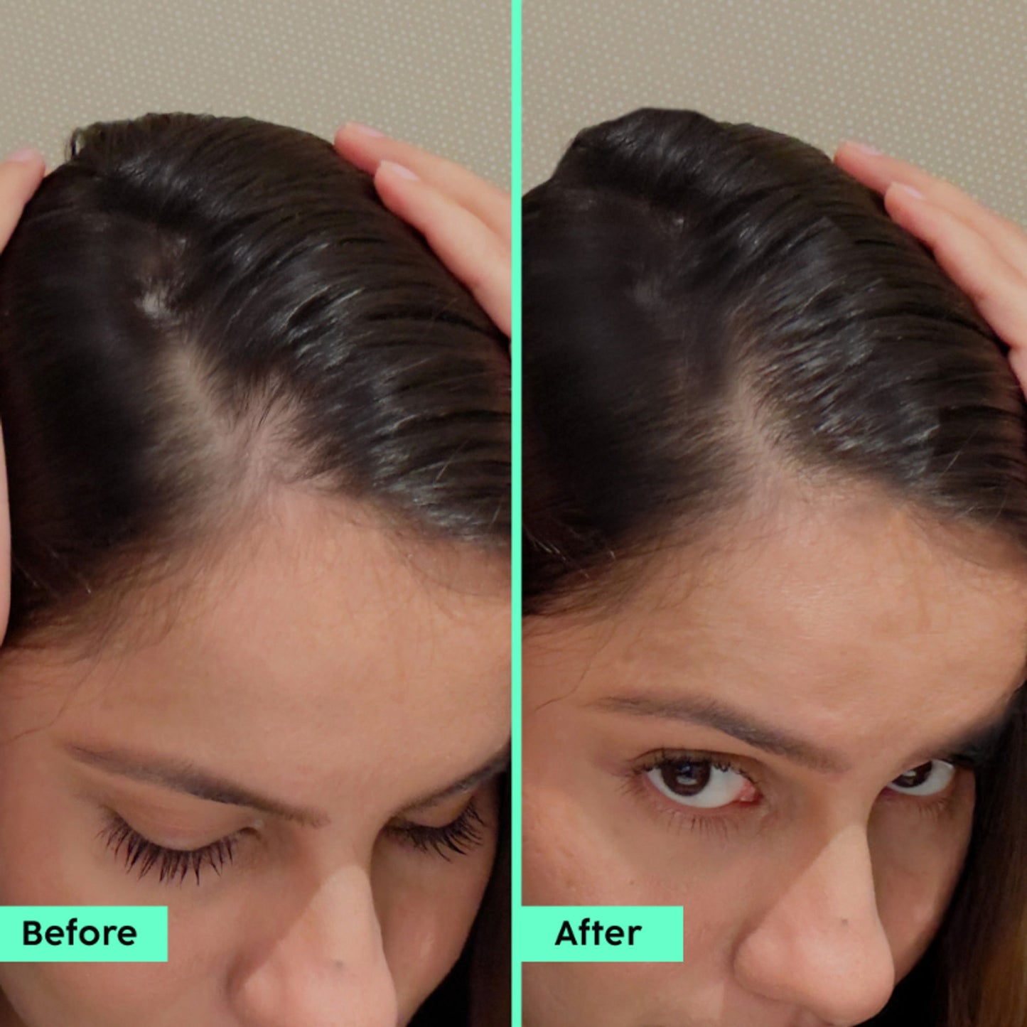 Plix Rosemary Hair Growth Advanced Serum Roll-On