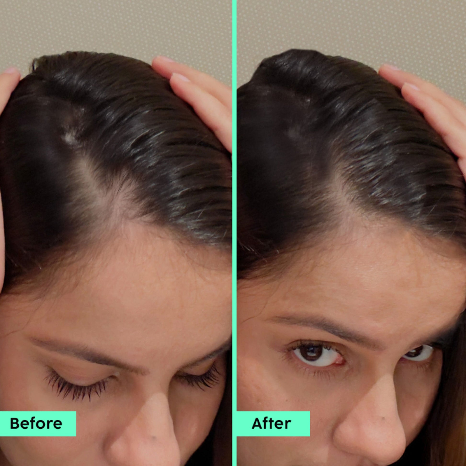 Plix Rosemary Hair Growth Advanced Serum Roll-On