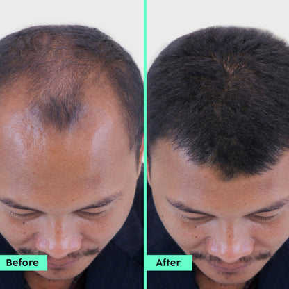 Plix Rosemary Hair Growth Advanced Serum Roll-On