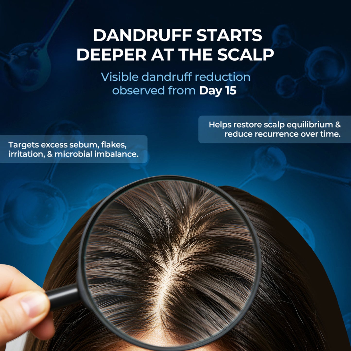 Streax Professional Anti Dandruff Hair Mask