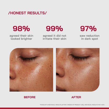 Proven Honest Derma (PHD) 10% Vitamin C Brightening Serum