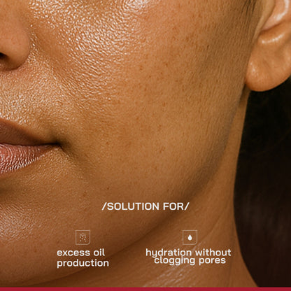 Proven Honest Derma (PHD) 3% Niacinamide Oil-Free Moisturizer
