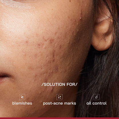 Proven Honest Derma PHD 10% Niacinamide Spot Correcting Serum
