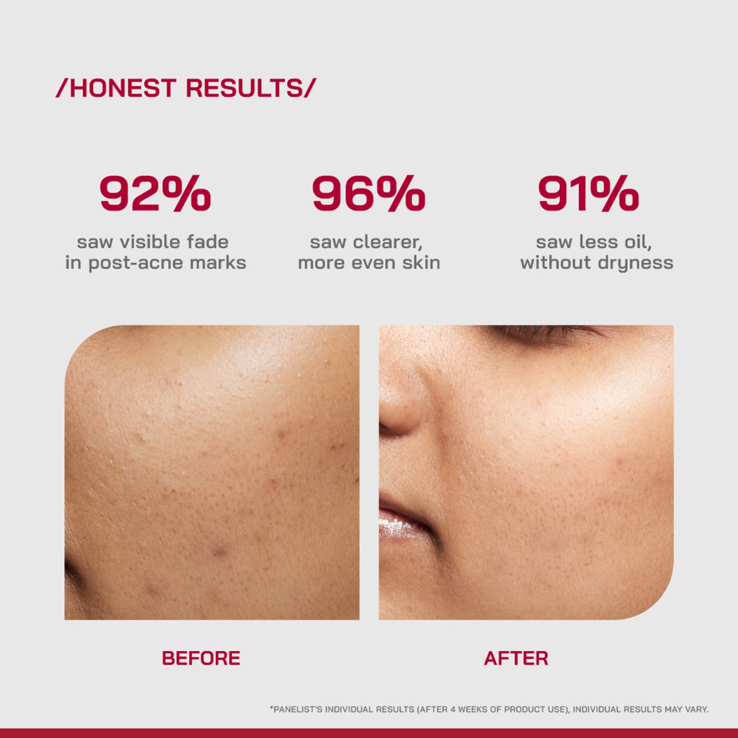 Proven Honest Derma PHD 10% Niacinamide Spot Correcting Serum