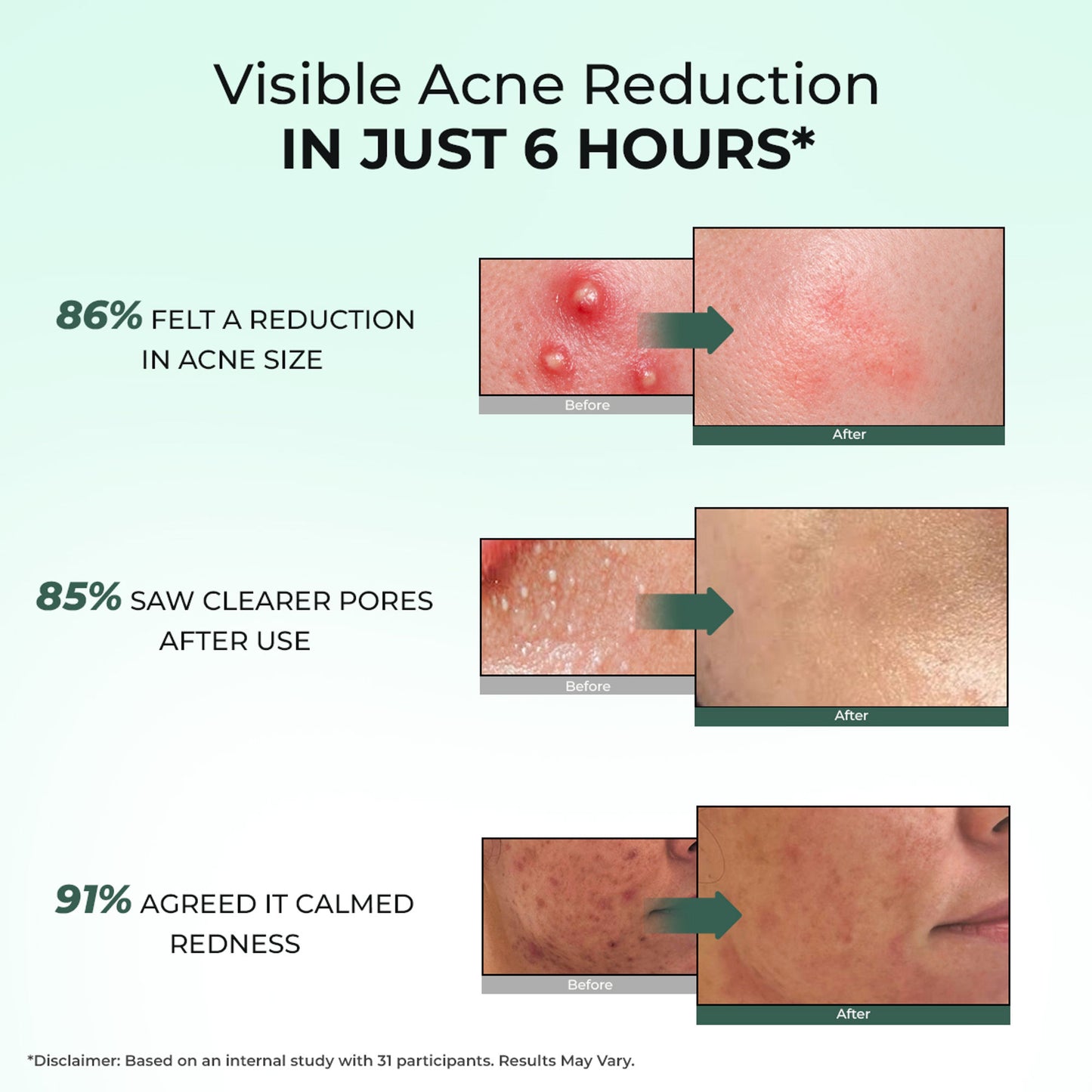 Conscious Chemist Rapid Relief Acne Spot Corrector Gel