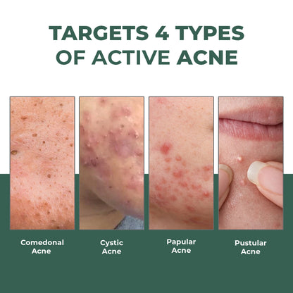 Conscious Chemist Rapid Relief Acne Spot Corrector Gel