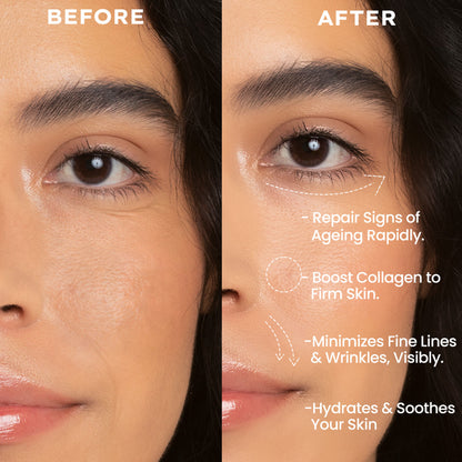 Hyphen 0.1% Retinal Reset, Retinol Derivative Serum Pro For Anti Aging, Reduce Fine Lines & Wrinkles