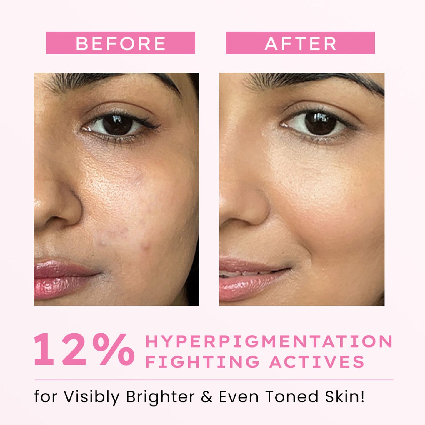 Hyphen Advanced De-Pigmentation Serum