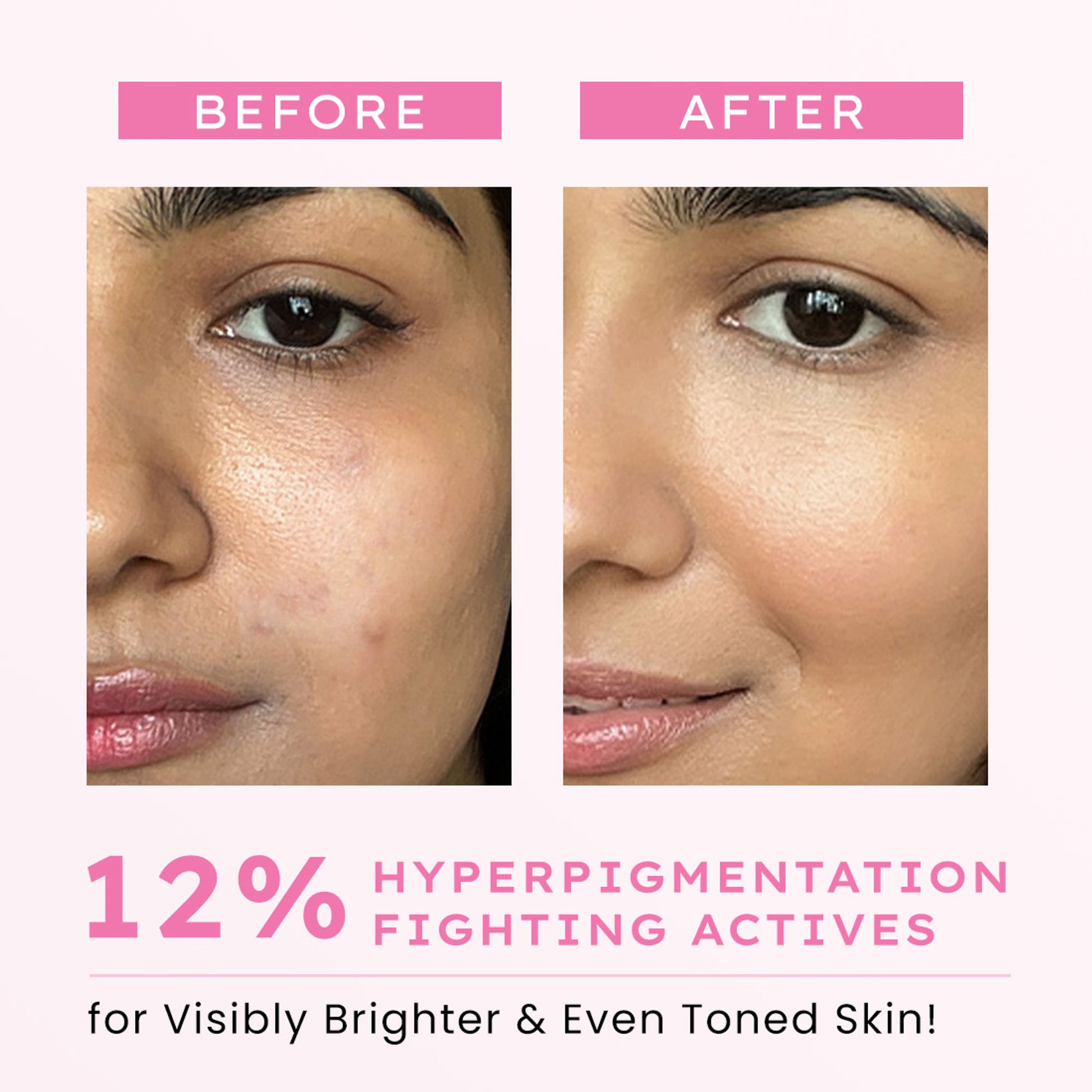 Hyphen Advanced De-Pigmentation Serum