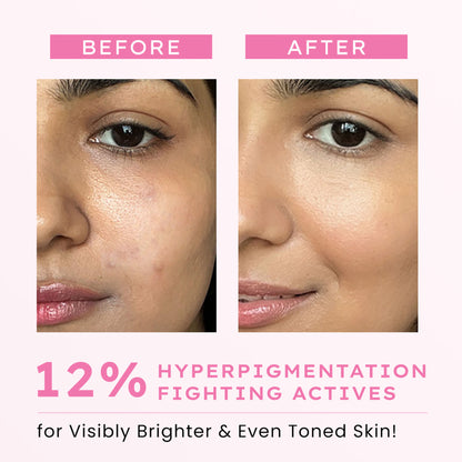 Hyphen Advanced De-Pigmentation Serum
