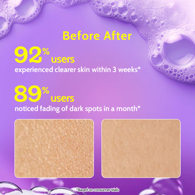Chemist at Play Vitamin C Brightening Face Wash Face Cleanser for Oily&Dry Skin