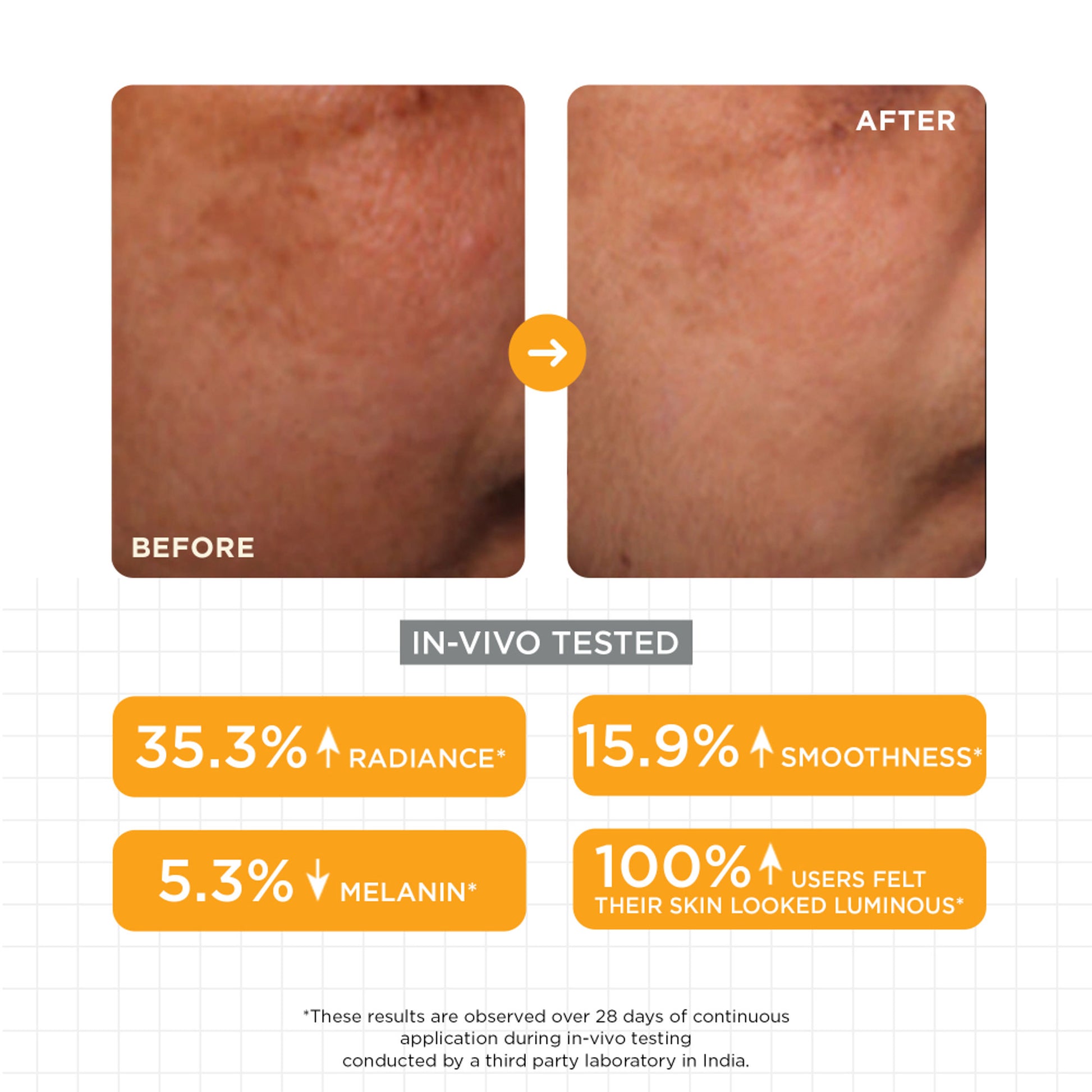 SKINQ Brightening Serum with Lactic & Malic Acid