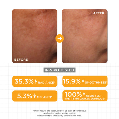 SKINQ Brightening Serum with Lactic & Malic Acid