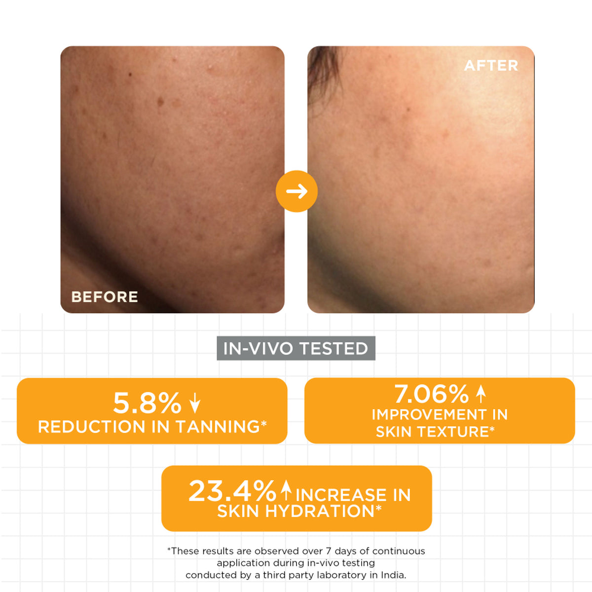 SKINQ 15% Vitamin C Glow Serum with L Ascorbic & Ferulic Acid, Reduces Tan & Brightens Skin