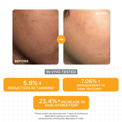 SKINQ 15% Vitamin C Glow Serum with L Ascorbic & Ferulic Acid, Reduces Tan & Brightens Skin