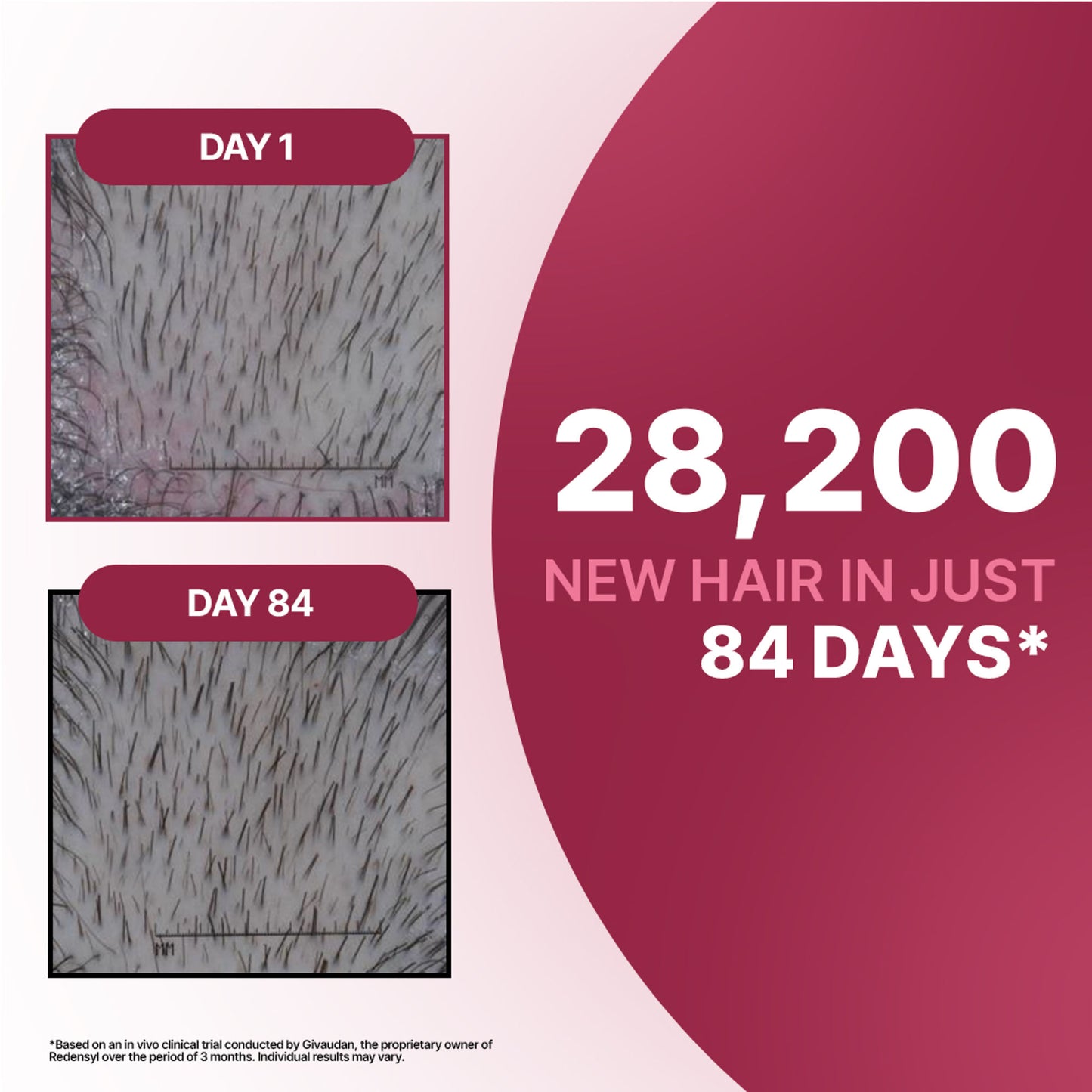 Sotrue 12% Hair Growth Actives Serum For Scalp - Redensyl, Procapil, Anagain & Baicapil