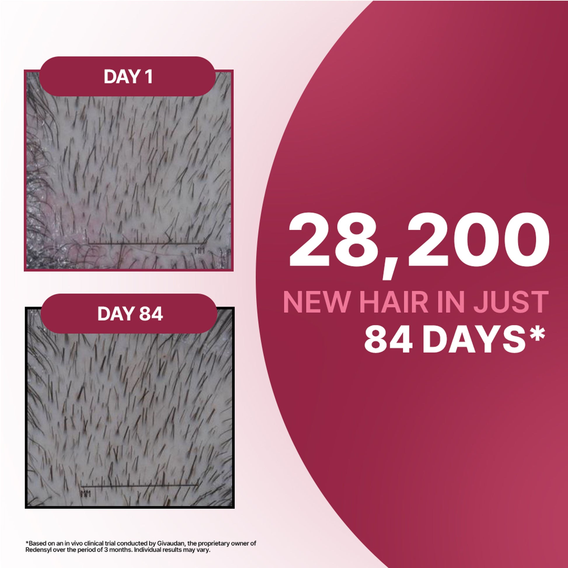 Sotrue 12% Hair Growth Actives Serum For Scalp - Redensyl, Procapil, Anagain & Baicapil